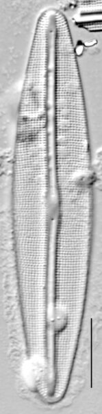 Frustulia incluta LM5