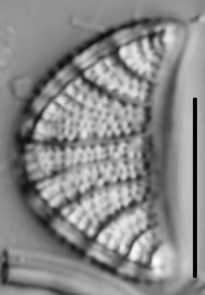 Rhopalodia musculus LM2