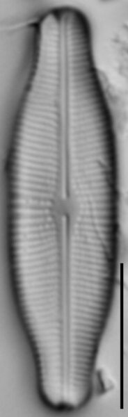 Prestauroneis protracta LM5