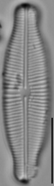 Prestauroneis protracta LM2