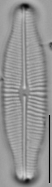 Prestauroneis protracta LM1