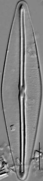 Frustulia saxonica LM4