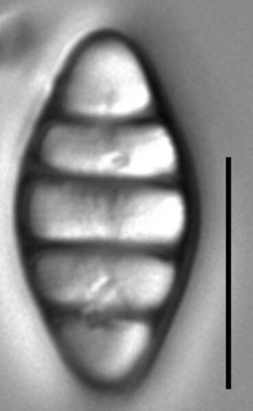 Tetracyclus hinziae LM4