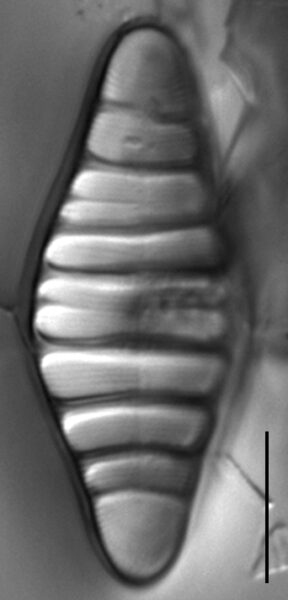 Tetracyclus hinziae LM3