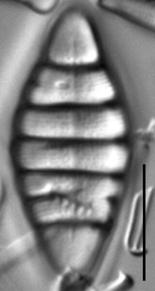 Tetracyclus hinziae LM2