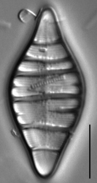 Tetracyclus hinziae LM1