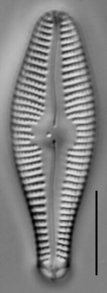 Gomphonema ventricosum LM2