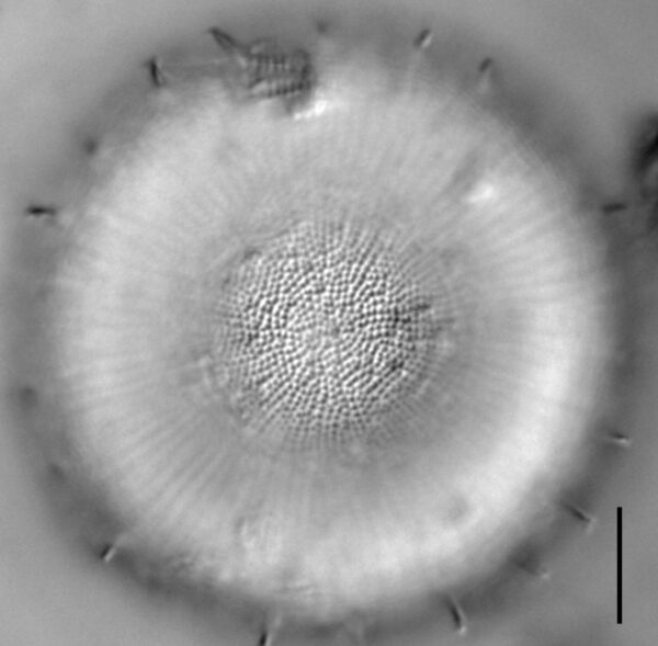 Stephanodiscus yellowstonensis LM7