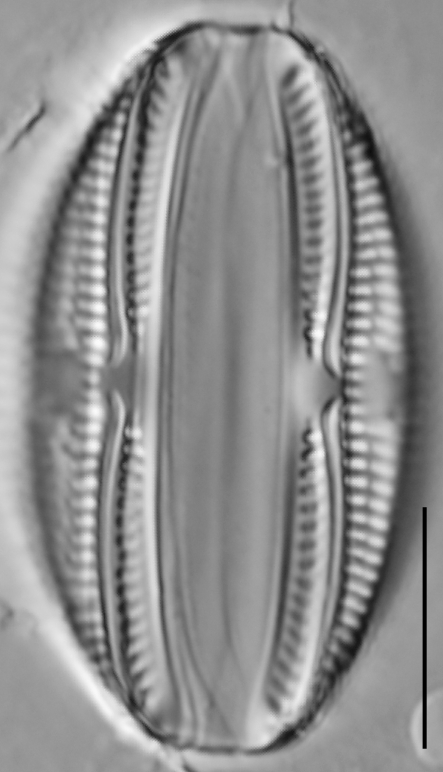 Amphora copulata LM1