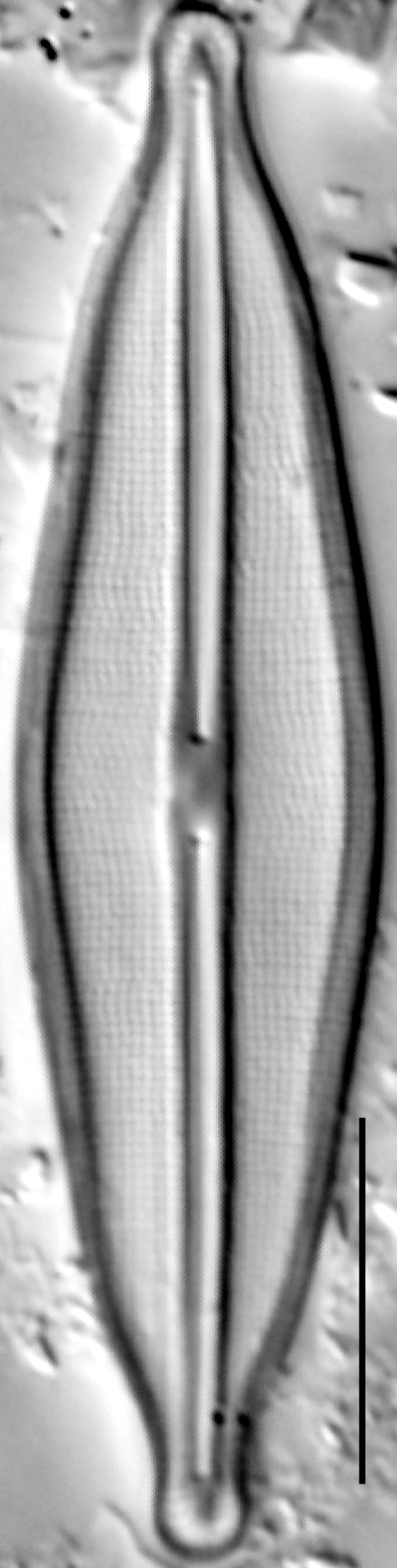 Frustulia crassinverva LM5