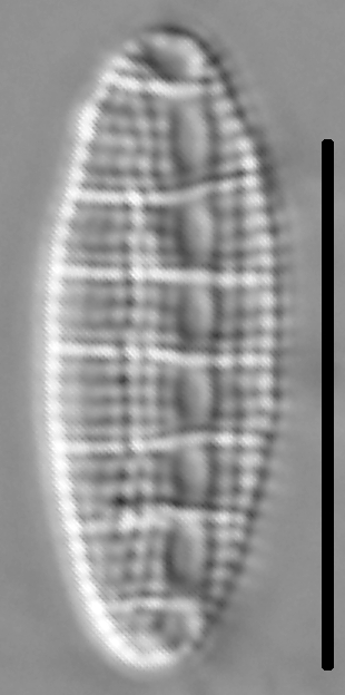 Denticula Tenuis 004