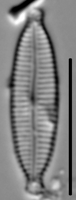 Encyonemopsis Subminuta 001