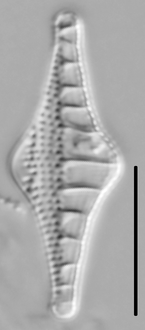 Nitzschia sinuata var tabellaria LM6