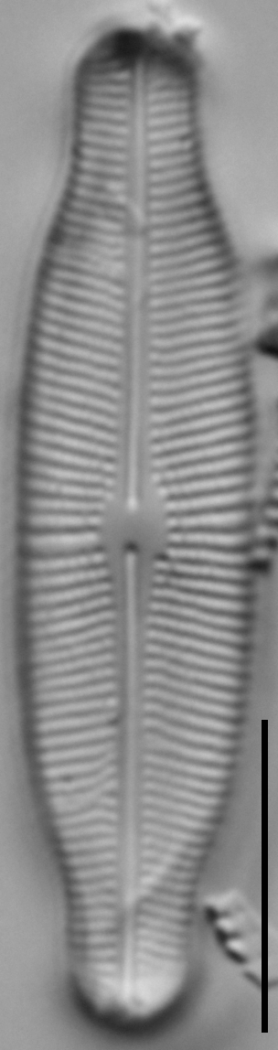 Prestauroneis protracta LM4