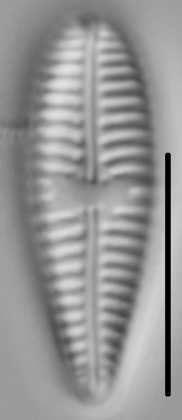 Gomphoneis pseudo-okunoi LM5