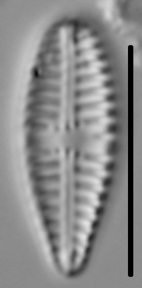 Gomphoneis pseudo-okunoi LM1