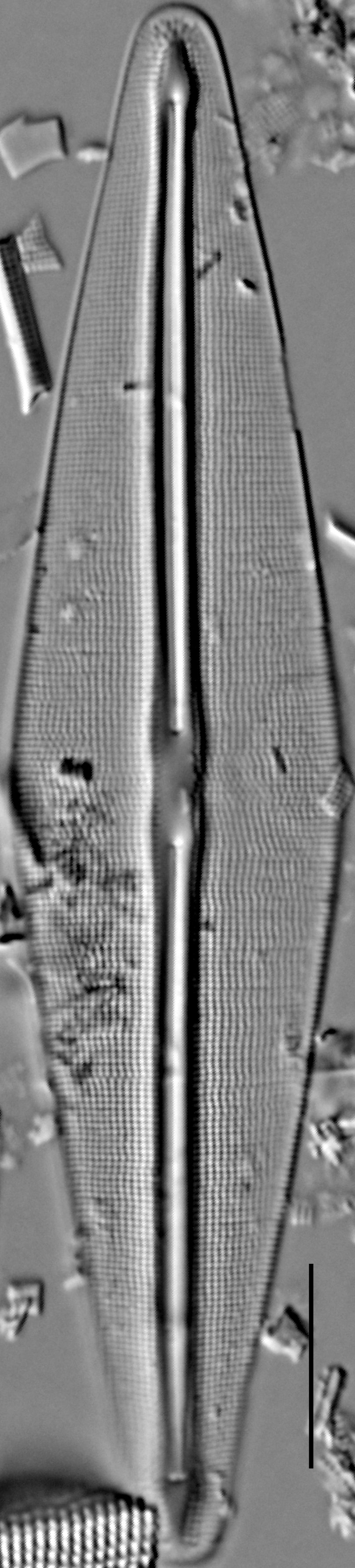 Frustulia saxonica LM5