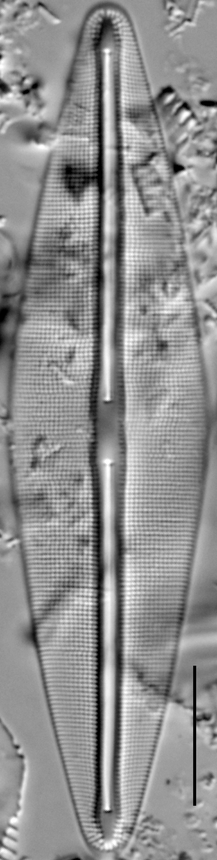 Frustulia saxonica LM3