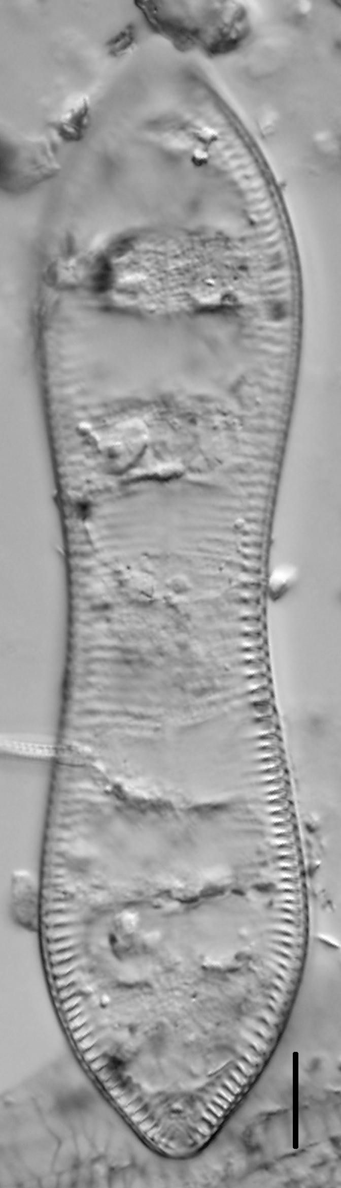 Cymatopleura solea LM3