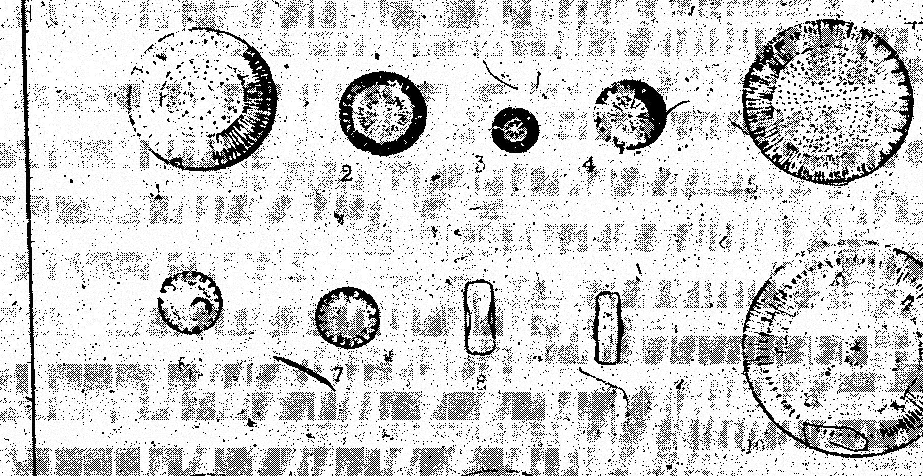 Cyclotella comta var. radiosa orig illus