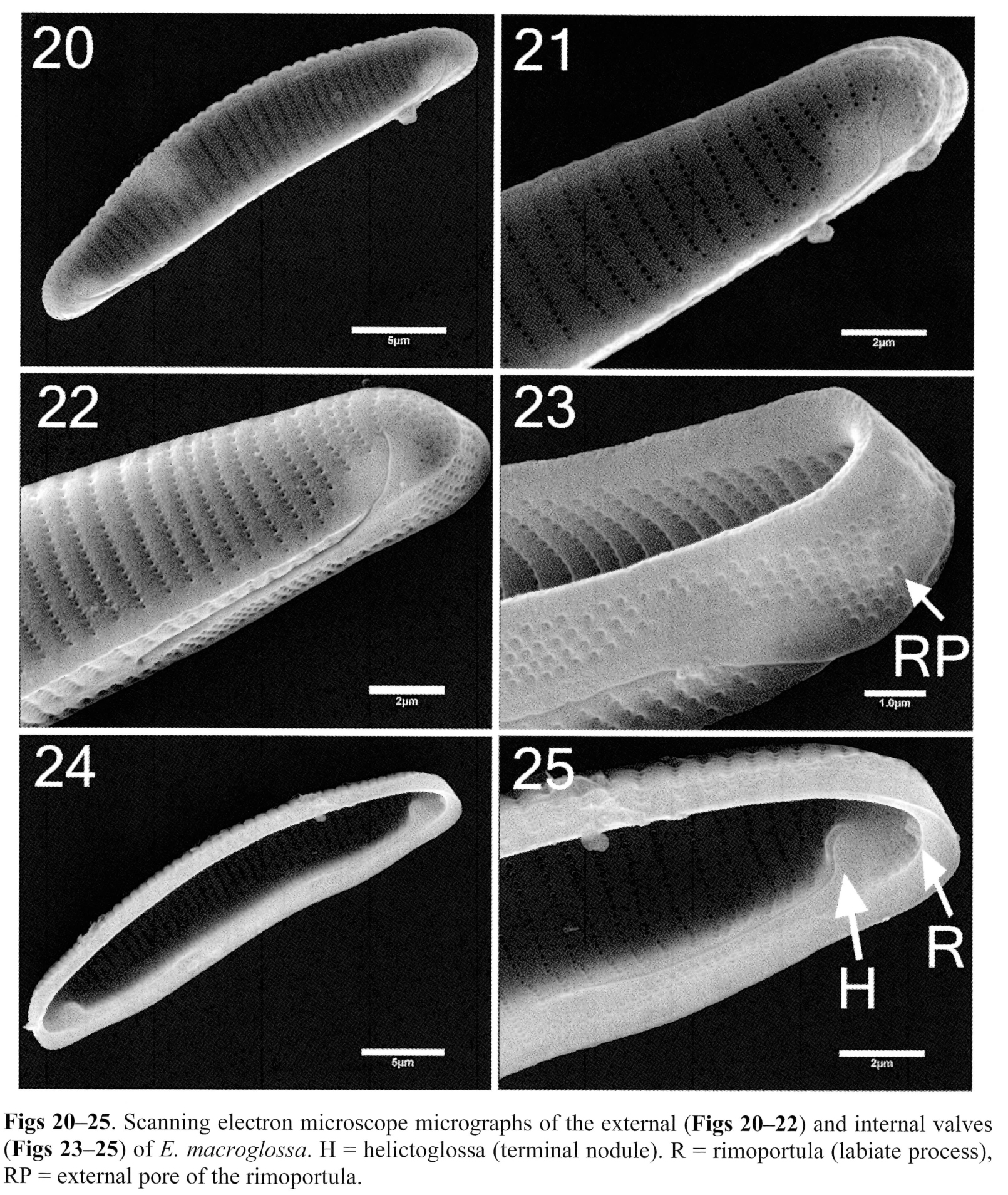 Eunotia macroglossa SEM