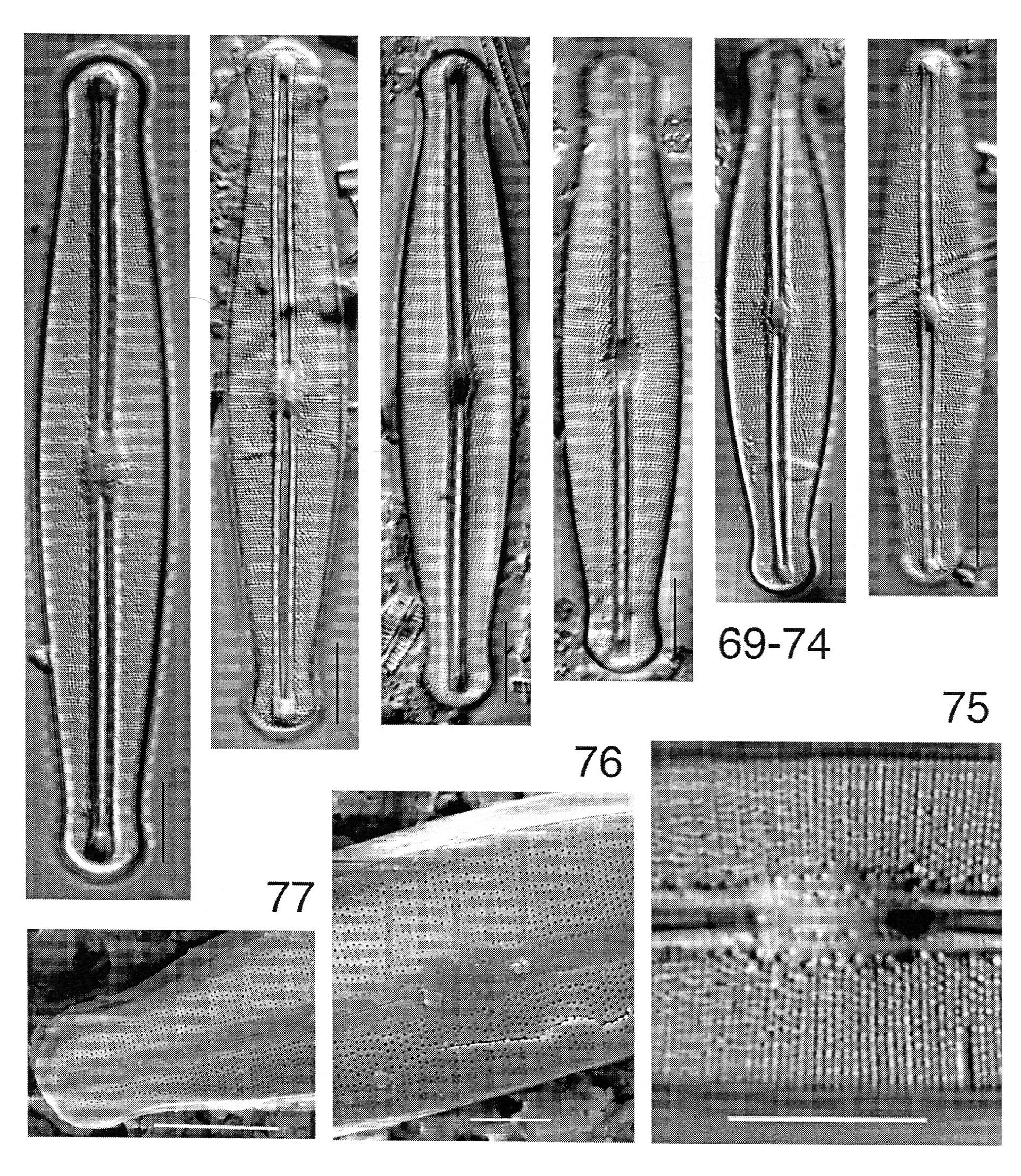 Frustulia esandalliae orig illus