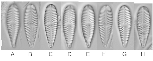 Gomphonella Olivacea Lectotype