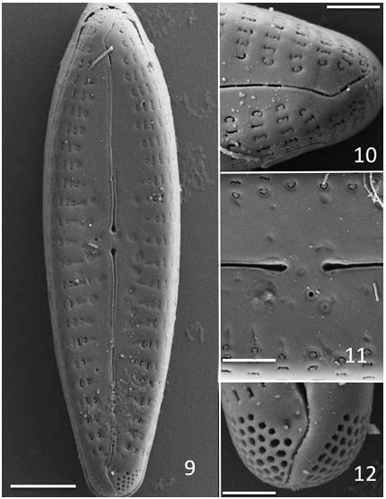 Gomphonema Insularum  Kociolek  Woodward  Graeff 2016  Sem