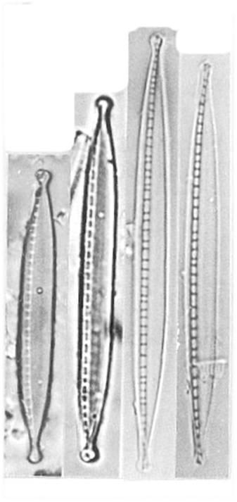 Nitzschia Dissipata Ver Oligotraphenta