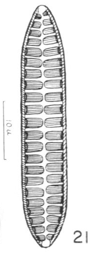 Surirella Terryi Var Arctica Orig Image  Pf1961