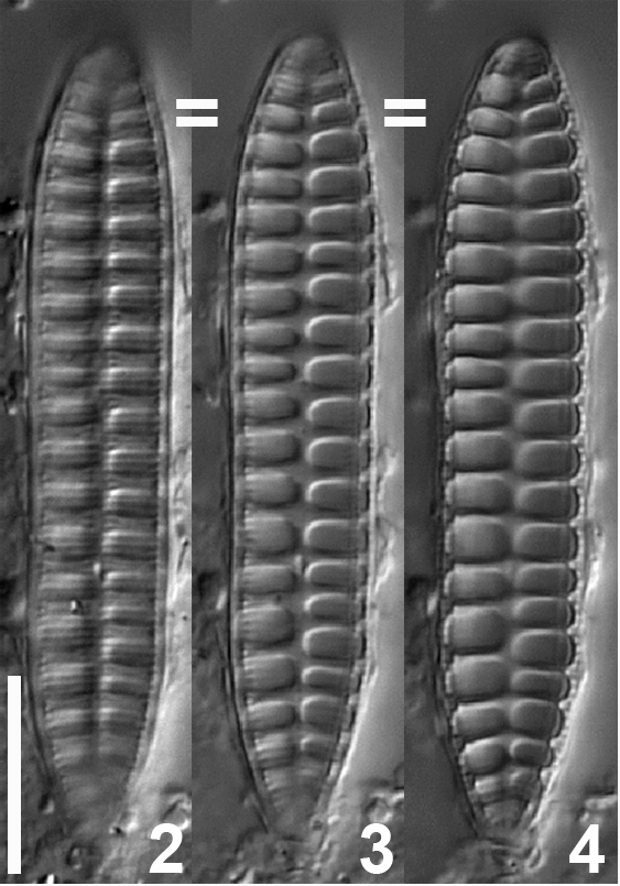 Surirella Terryi Var Arctica Orig Image  Vp2014