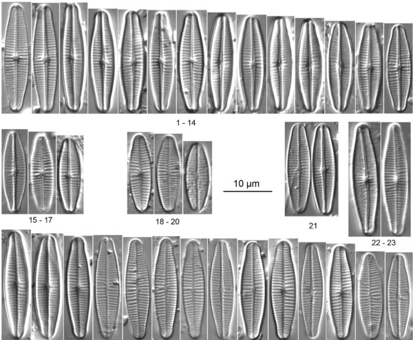 Achnanthidium druarti orig illus