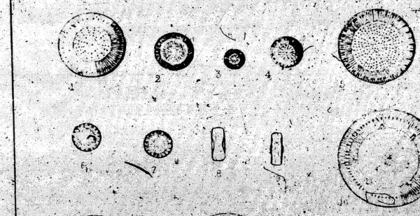 Cyclotella comta var. radiosa orig illus