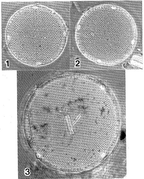 Eupodiscus radiatus LECTOTYPE