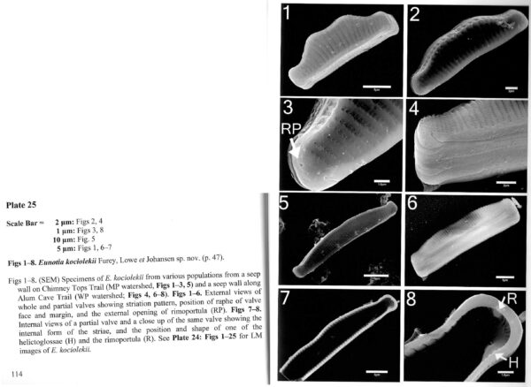 Eunotia Kciolekii Platescan Ii