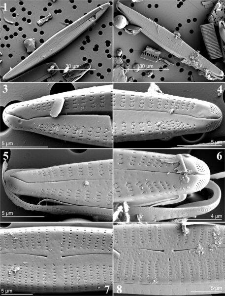 Figs1 8 Gomphonema Eileencoxiae Sem