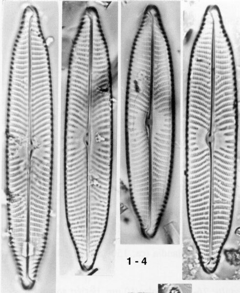 Naviridulacal Neomund