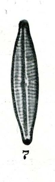 Navicula Canalis