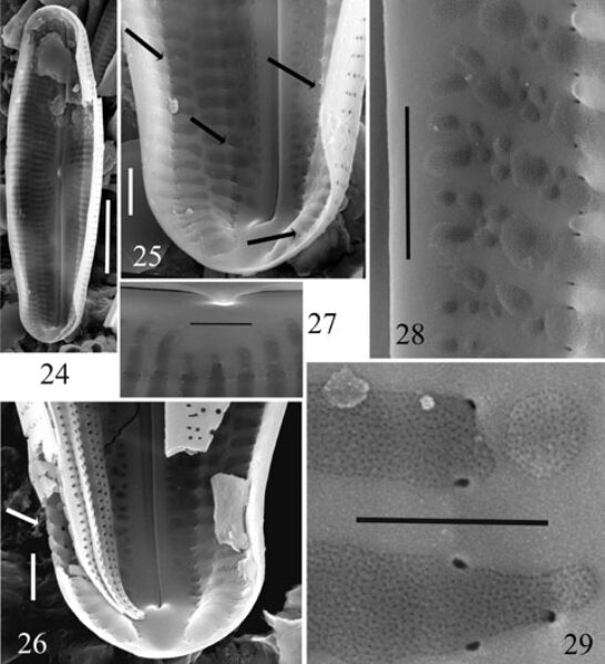 Neidiopsis  Bahls  Figures 24 29