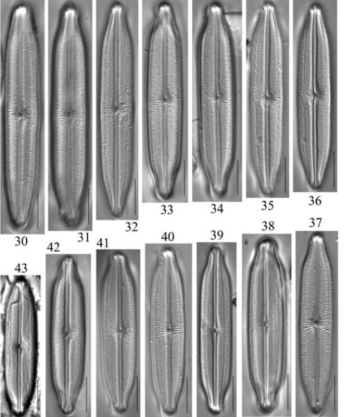 Neidiopsis  Bahls  Figures 30 43