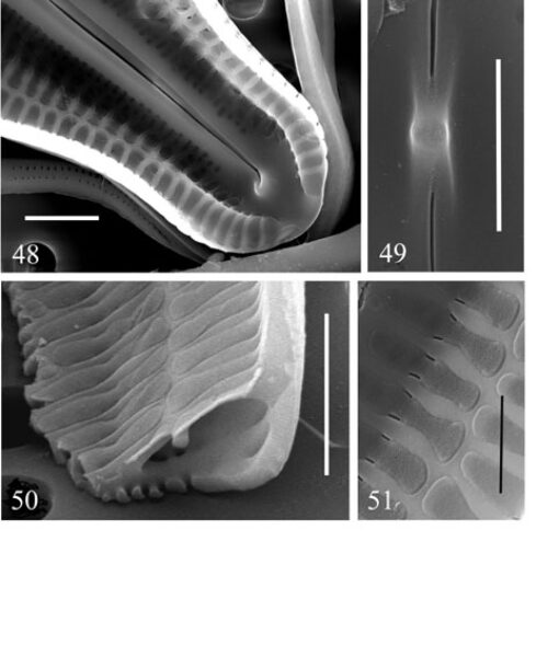 Neidiopsis  Bahls  Figures 48 51