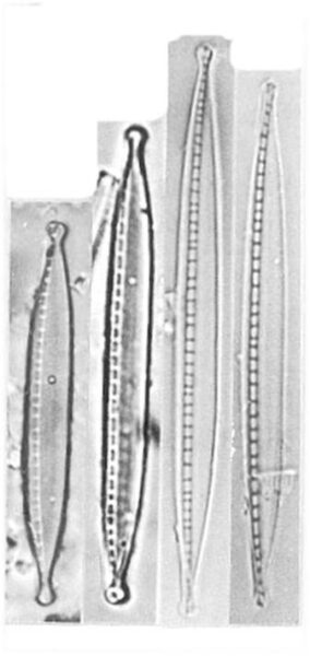 Nitzschia Dissipata Ver Oligotraphenta