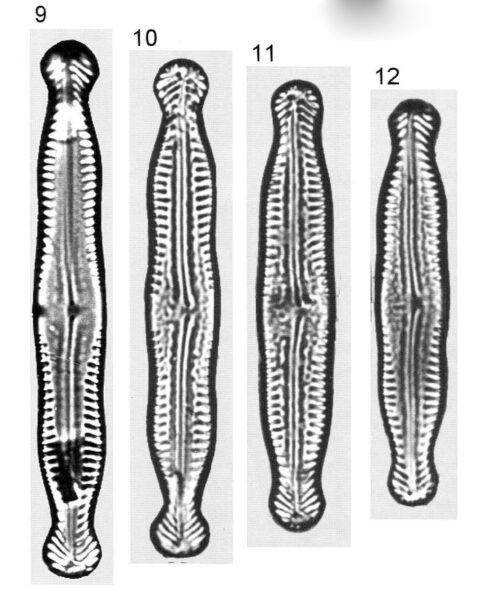 Pinnularia Nodosa Percapitata Origimag1001