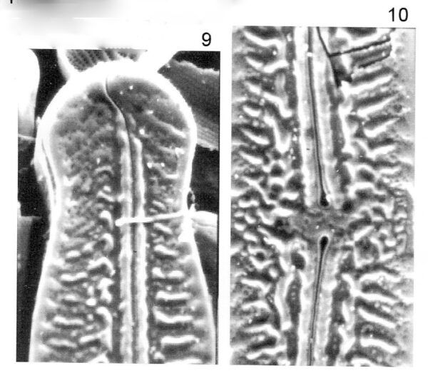 Pinnularia Nodosa Percapitata Origimag2002