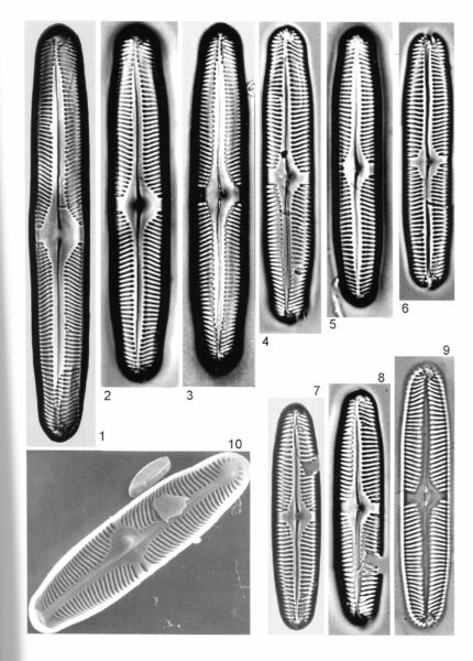 Pinnularia Rhombarea Origimag1001