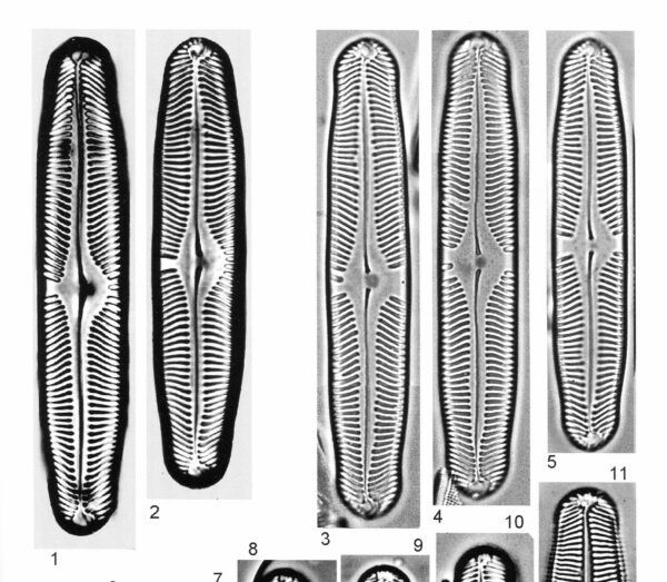 Pinnularia Rhombarea Origimag2002