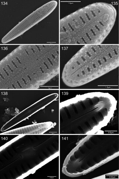 Gomphosphenia Stoermeri orig illus SEM