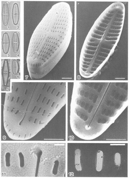 Hip Pseudacceptata Orig Desc Plate