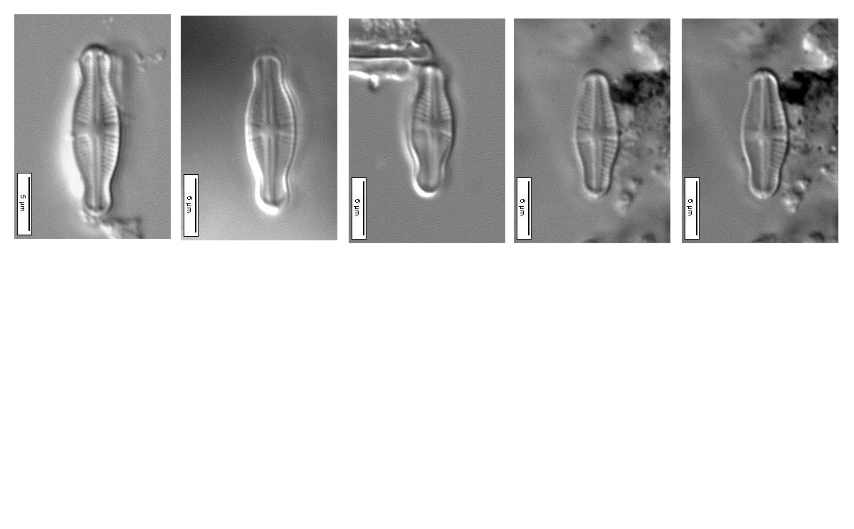 Hustedt neotypes