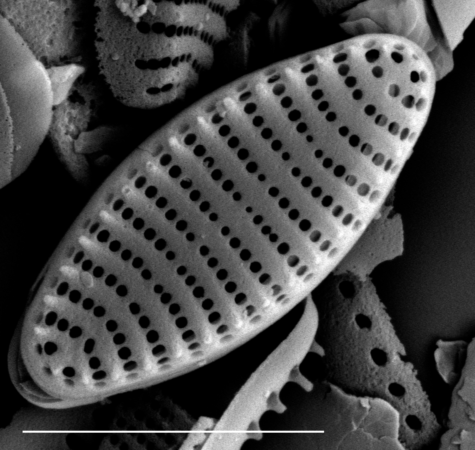  Stauroforma exiguiformis SEM1